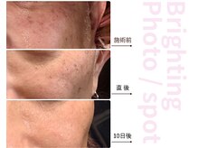 ドアディ(Doordie)の雰囲気（美肌リフトアップ専門だからこそ、圧倒的満足度・圧倒的効果！）