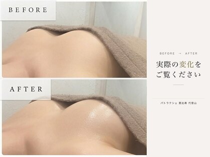 パトラクシェ 恵比寿 代官山(Patolaqshe)の写真