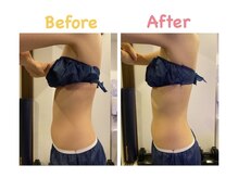 クレビア 麻布十番(CREBIA)/【痩身/代謝促進】