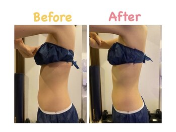 クレビア 麻布十番(CREBIA)/【痩身/代謝促進】