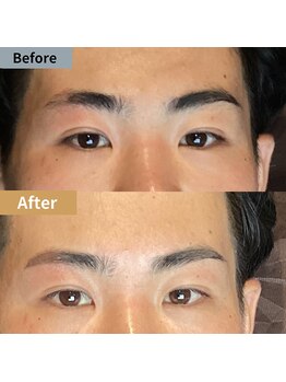 眉毛ハウス 吉祥寺店(眉毛HOUSE)/お客様の施術例(吉祥寺/東京)