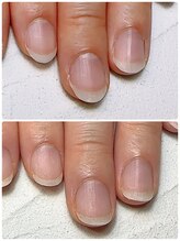 スマイルニコ(smile nico)/ピンクの土台を伸ばしたい