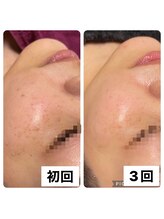 ビューティーサロン キャンディ 海老名(Candy)/