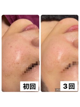 ビューティーサロン キャンディ 海老名(Candy)/