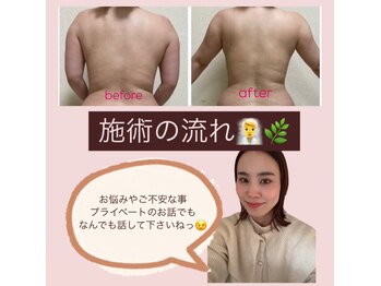 ヨサパーク リアン(YOSA PARK Lien)/施術の流れ♪よもぎ蒸し