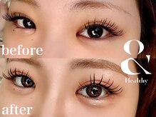 シャルモン(charmant)の雰囲気（まつパ/フラットラッシュ/LED/バインドロック/アンドヘルシー有）