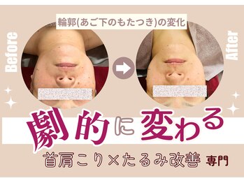 ココリラ(cocorela)