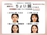 【選べる美容鍼】40分で変わる！4つの悩みから選ぶ短時間美容鍼(電気あり) 