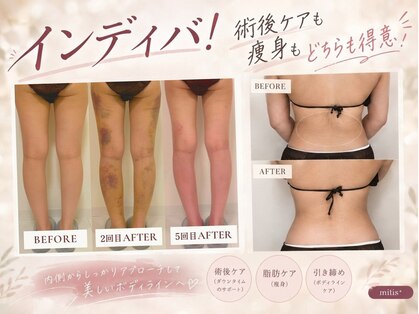 ミーティスの写真