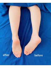 アナパナパ(anapanapa)/ボディトリートメント