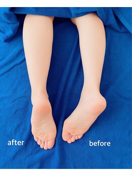 アナパナパ(anapanapa)/ボディトリートメント