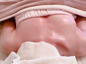 ローズルート(Rose route)の写真/【サイズアップや美乳・形に特化】お身体に合うオーダーメイド施術/大きさ/産後/下垂/げっそりデコルテ