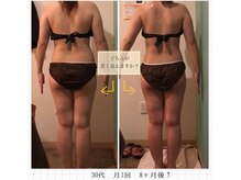 グレッセン(glanzen)/【30代/8回/8ヶ月後】