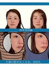 ハリラボ(hari Lab.)/【お客様の声】