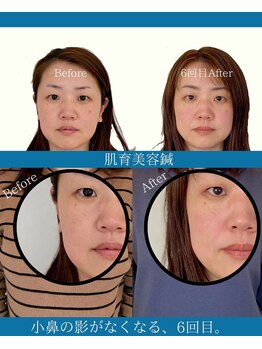 ハリラボ(hari Lab.)/【お客様の声】