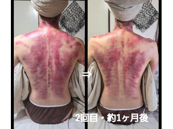 オアシス(OASIS)/ホット★カッサ