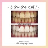 ホワイトニングショップ 出雲店