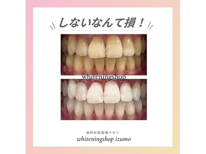 ホワイトニングショップ 出雲店の写真
