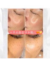 ビオエル(Bioell)/狭山市発導入★ララピール♪♪