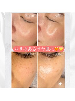 ビオエル(Bioell)/狭山市発導入★ララピール♪♪