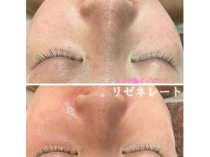 リス ブラン(Lys Blanc)の写真