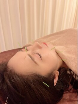 茶ノ木鍼灸整骨院の写真/「もっと顔をすっきり見せたい」「写真に写る自分の輪郭が気になる」そんな悩みを抱えている方にオススメ☆