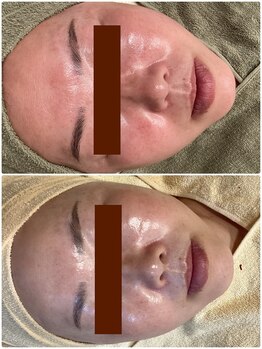 フォーユー 飯能店(Foryou)/セルマン 艶玉肌