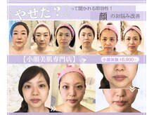 小顔美肌コルギ専門店 センティード 吉祥寺(Sentido)