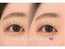 ユーロ(EURO)/&healthy80本