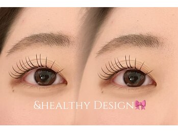 ユーロ(EURO)/&healthy80本