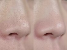 GENTLE SKIN銀座駅前店[メンズ小顔/毛穴洗浄/エステ/メンズ眉毛/メンズ脱毛/全身脱毛]の雰囲気（[銀座全身脱毛/銀座アイブロウ/銀座眉毛/銀座毛穴洗浄/銀座小顔]）