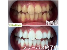 ルブラン 奈良店(Le Blanc)/第一印象を左右する歯
