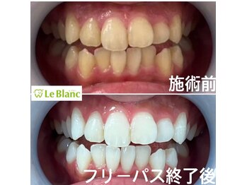 ルブラン 奈良店(Le Blanc)/第一印象を左右する歯