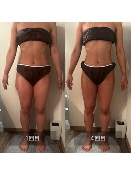 フィエルテ 甲斐敷島(FIERTE)/before after