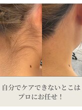 アンビワン(Anbione.)/ビフォーアフター