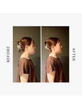 リム(Rim.)/ストレートネック改善！