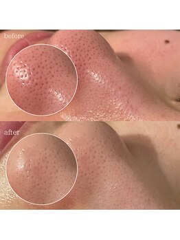 ペイジ(peige)/【peige】症例写真