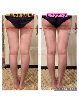 アユスリム(AYU SLIM)/施術一回目から結果出します!