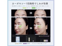 プラスベル(plus Belle)/高濃度炭酸ガスパック