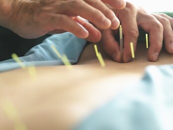 ボディーキュア アオイ(Body cure Aoi)の写真/【マッサージ・鍼灸をお身体に合わせて施術◎】施術歴20年の院長による本格施術で繰り返す腰痛にさよなら!