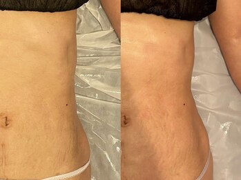 エクラ(eclat)/セルクラ