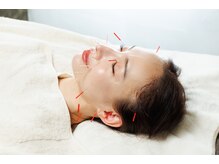 カリスタ 恵比寿駅前店の雰囲気（美容鍼で、フェイスラインのもたつき・むくみをすっきり◎）