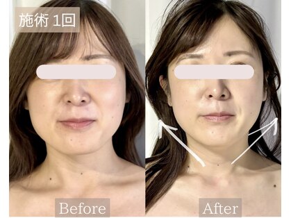 サロンドベベ(salon de Bebe.)の写真