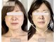 サロンドベベ(salon de Bebe.)の写真