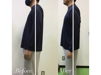 リトラ(Retra)/整体・BeforeAfter