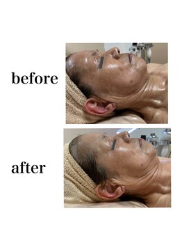 ステラ(stella)/肌の色ムラをなくす