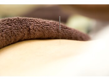 ゆずりは鍼灸整骨院/鍼