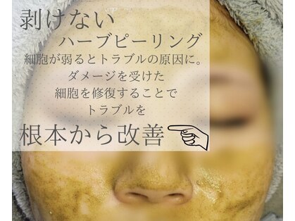 エピシア(EPISIA)の写真