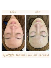 アモール 丸亀店(Amor)/眉毛/まつげパーマ/毛穴/脱毛