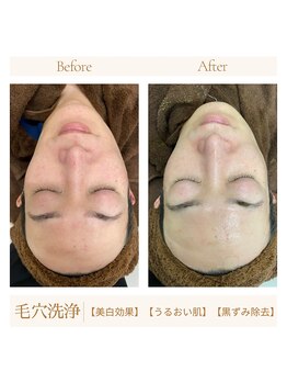 アモール 丸亀店(Amor)/眉毛/まつげパーマ/毛穴/脱毛